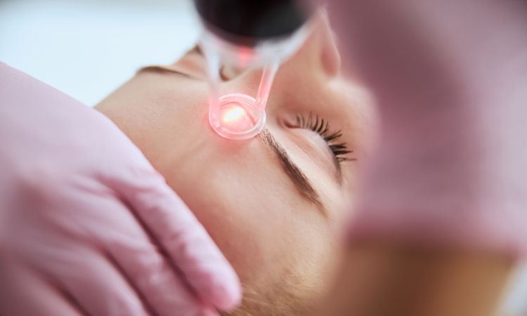 Công nghệ Laser điều trị da nổi đốm nâu không ngứa 