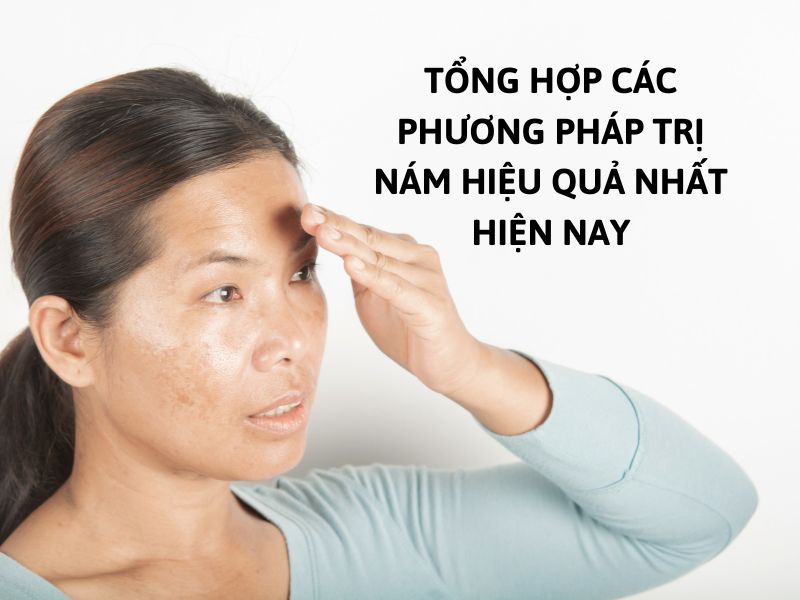 các phương pháp trị nám 