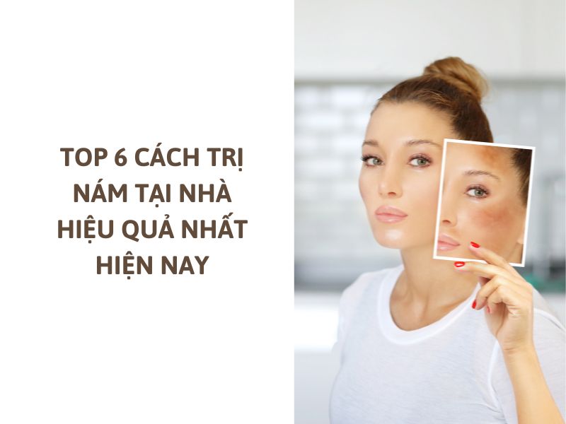 cách trị nám 