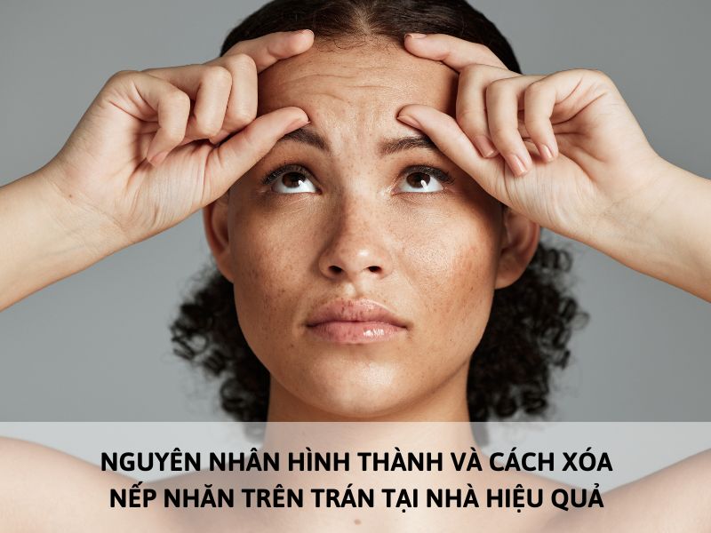 cách xóa nếp nhăn trên trán tại nhà