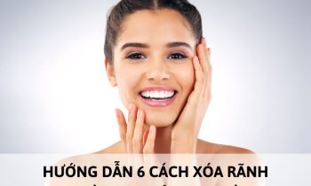 cách xóa rãnh cười