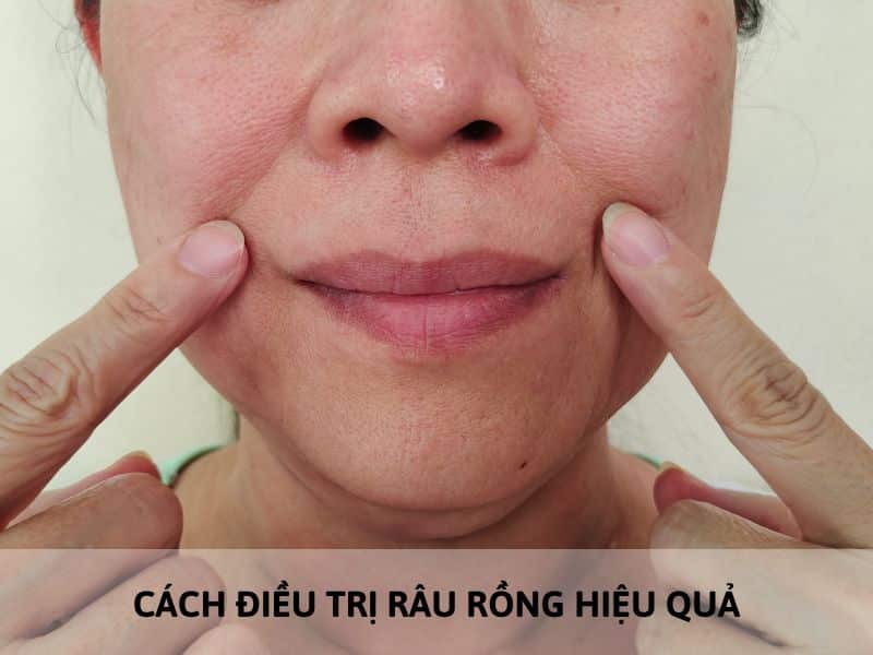 râu rồng là gì