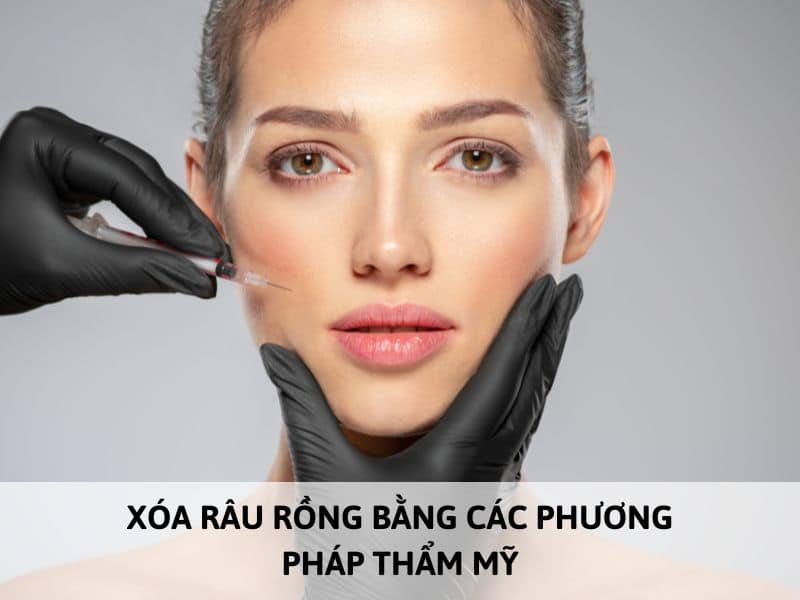 thẩm mỹ để loại bỏ râu rồng