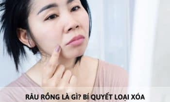 râu rồng là gì