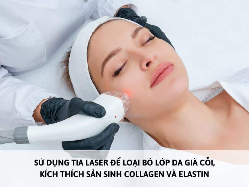 làm đẹp bằng tia laser