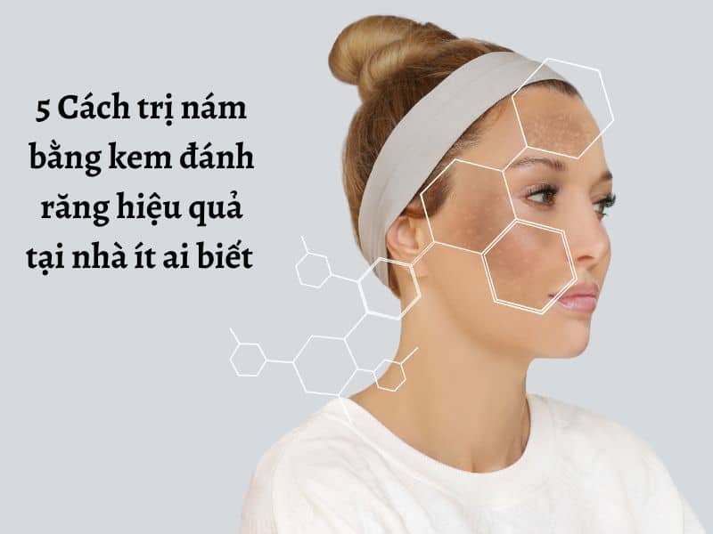 Trị nám bằng kem đánh răng