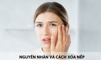 xóa nếp nhăn vùng mắt