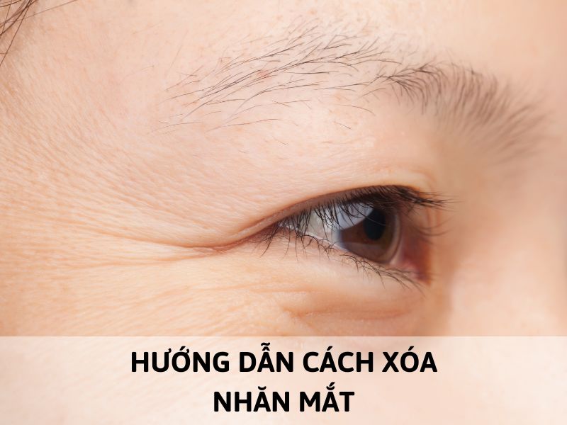 xoá nhăn mắt