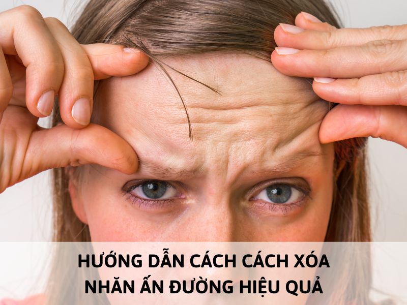 Xóa nhăn ấn đường