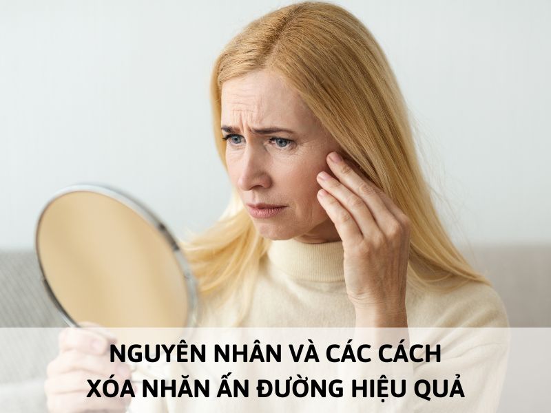 Xóa nhăn ấn đường